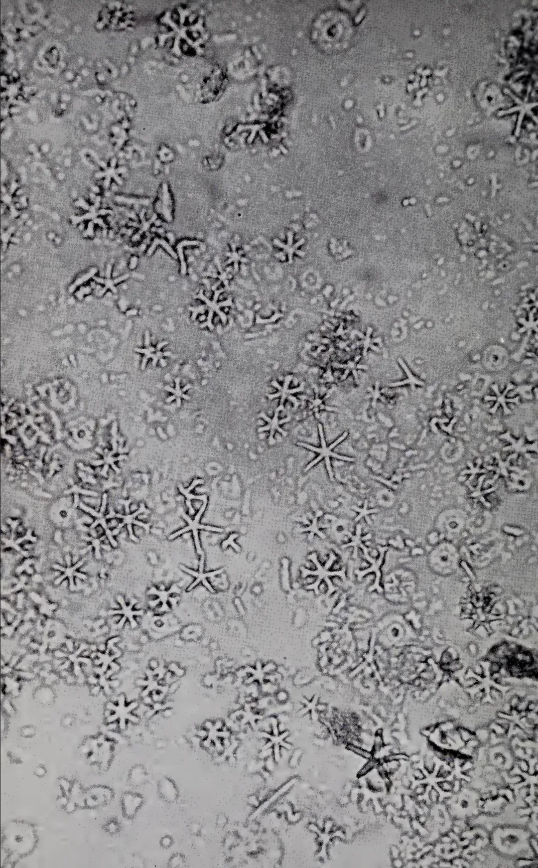 Calcareous deep-sea sediment with coccoliths and discoasters